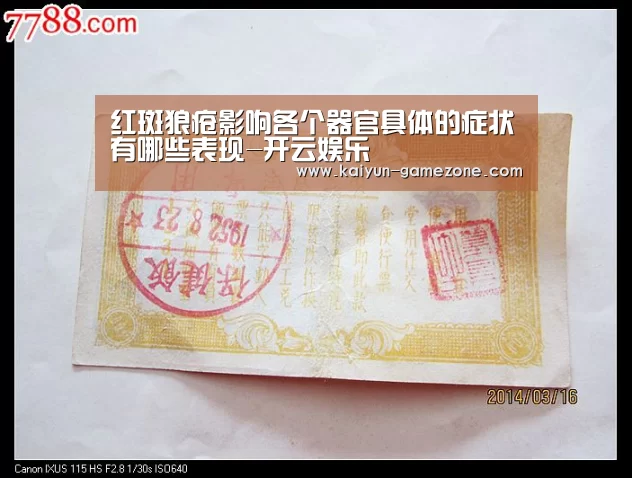 红斑狼疮影响各个器官具体的症状有哪些表现-开云娱乐(图2) 开云娱乐